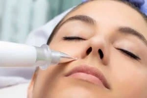 Best Actinic Keratoses Removal 3 Actinic keratoses Suffolk solutions - book in today!